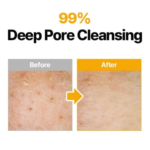MANYO Pure Cleansing Oil, Natural Oil Cleanser for Face, Makeup Blackhead Remover, Korean Skin Care, 6.76 fl oz (200ml) thumbnail 4