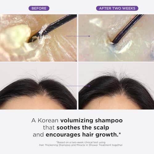 Dr. Groot Hair Thickening Shampoo, Korean Hair Care with Biotin, Rosemary Oil to Help Volumize Thinning, Damaged Hair, Hydrate Hair and Scalp, Biotin Shampoo, Scalp Revitalizing Solution thumbnail 7