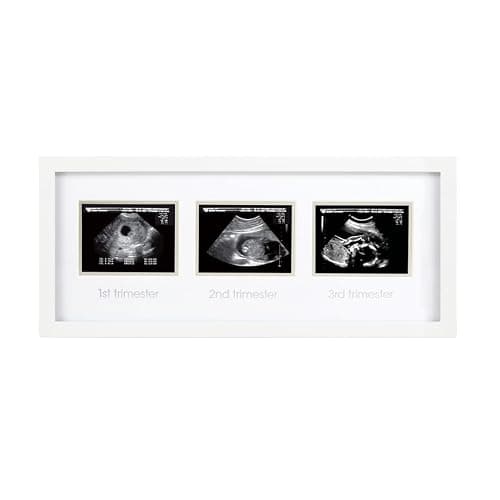 Pearhead Sonogram Progression Frame - Trimester Pregnancy Milestone Keepsake, Gender-Neutral Nursery Decor, Displays 1st, 2nd & 3rd Trimesters Ultrasound Photos, White - Image 1