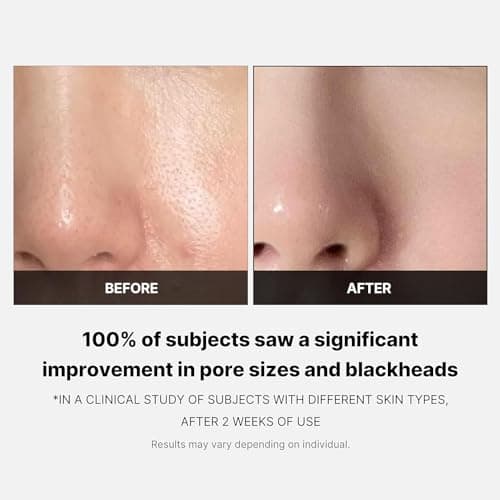 Medicube Zero Pore Pads 2.0 - Dual-Textured Facial Toner Pads for Exfoliation and Minimizing Pores with 4.5% AHA Lactic Acid & 0.45% BHA Salicylic Acid - Ideal for All Skin Types - Korean Skin Care thumbnail 5