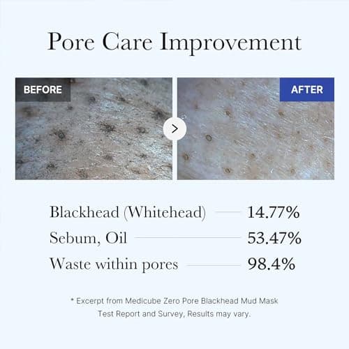 medicube All-in-One Duo for Pore and Skin Texture Care: Zero Pore Pads 2.0 and Zero Pore Blackhead Mud Facial Mask - 💗 thumbnail 4