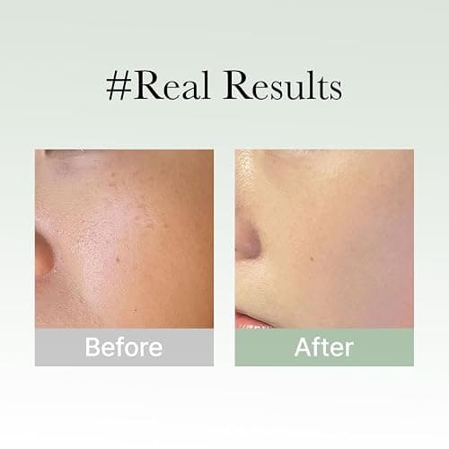 Arencia Glow Hyssop Overnight Face Mask Serum - hydrating & Anti-Aging Serum for younger looking Korean Glass Skin, Vitamin A, C, E, Niacinamide, Peptide thumbnail 7