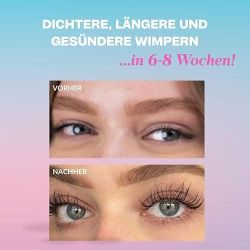 Annixashley Lash Wimpernserum für Premium Wimpernserum für Längere & Dichtere Wimpern – Wachstumsfördernde Formel mit Biotin und Peptiden – Sichtbare Ergebnisse in 6-8 Wochen thumbnail 4