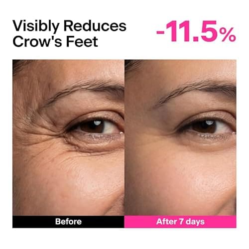 THOME CPR Serum - Collagen 1% + Peptide 1% + Retinal 0.1% Triple Synergy Mechanism, High Potency Firming Serum for Fine Lines & Wrinkles, Texture & Pore Refining, Korean Skincare, 1.01 fl oz. thumbnail 6