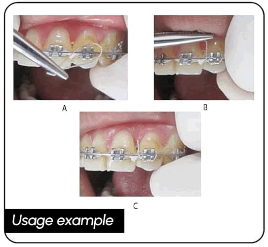 BELEON Braces Wire Orthodontic Dental Ligature Wire for Braces for Home Use Stainless Steel 40g 0.3mm thumbnail 5