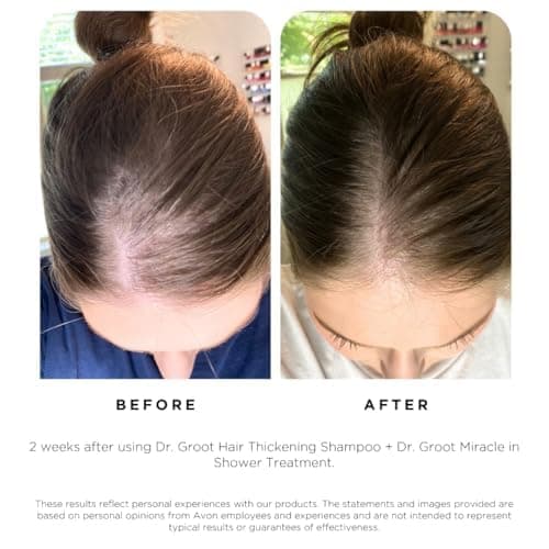 Dr. Groot Hair Thickening Shampoo, Korean Hair Care with Biotin, Rosemary Oil to Help Volumize Thinning, Damaged Hair, Hydrate Hair and Scalp, Biotin Shampoo, Scalp Revitalizing Solution thumbnail 5