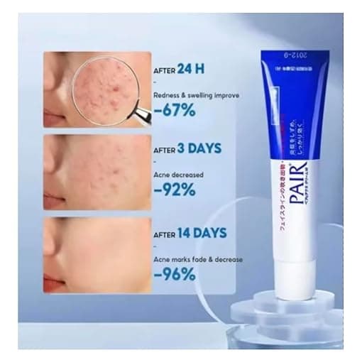 PAIR Acne Treatment Cream , Japanese Medicated Skincare 14g, Japan Lion acne cream thumbnail 5