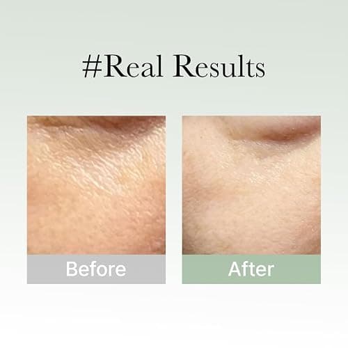 Arencia Glow Hyssop Overnight Face Mask Serum - hydrating & Anti-Aging Serum for younger looking Korean Glass Skin, Vitamin A, C, E, Niacinamide, Peptide thumbnail 8