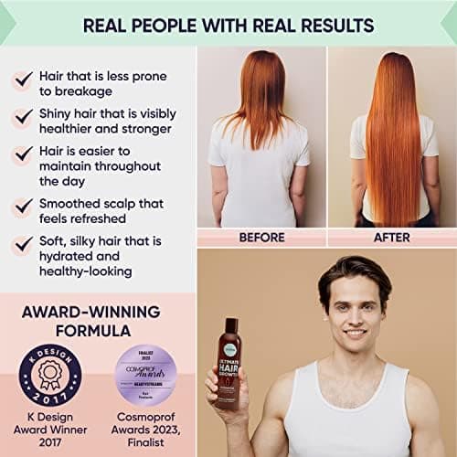 Moerie Mineral Hair Growth & Repair Mask – Restorative Treatment Hair Mask – Hair Treatment For Longer, Thicker, Fuller Hair - Vegan Hair Products – Paraben Free Hair Products – 3.4 oz (96.4g) thumbnail 4