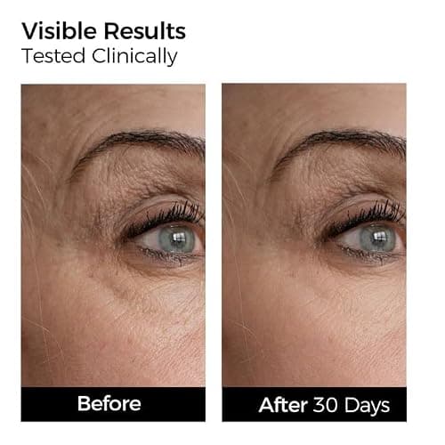 WNP serum set: Ultra Hydrating Serum 3% 4D Hyaluronic Acid +Emergency Repair Firming Oil-Suspension Serum Hydrating+Skin Repair|Single-Use Vials Skincare for Sensitiveskin 72ml thumbnail 7
