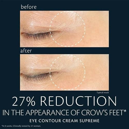 Clé de Peau Beauté, Eye Contour Cream Supreme thumbnail 6