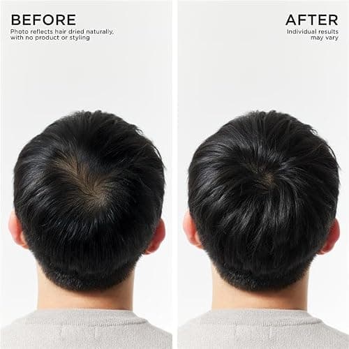 Dr. Groot Hair Thickening Shampoo, Korean Hair Care with Biotin, Rosemary Oil to Help Volumize Thinning, Damaged Hair, Hydrate Hair and Scalp, Biotin Shampoo, Scalp Revitalizing Solution thumbnail 4