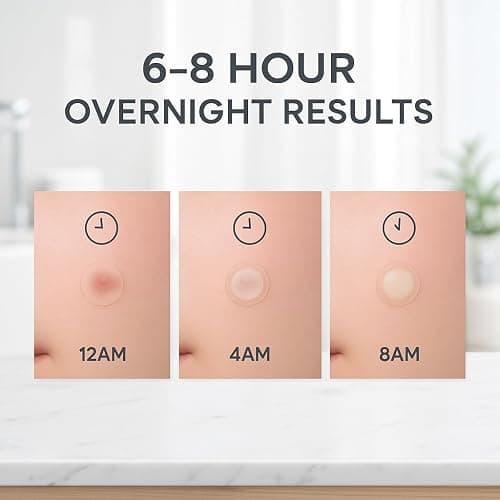 LE GUSHE K-BEAUTY Pimple Patches for Face (132 dots) - Hydrocolloid Acne Patch for Zits and Blemishes - Invisible Blemish Patches | Spot Cover Stickers for Glowing Skin | Korean Skin Care thumbnail 3