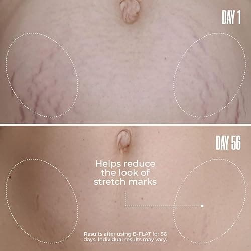 MAËLYS Cosmetics B-FLAT Belly Firming Cream - Stretch Mark, Tightening Belly Cream thumbnail 3