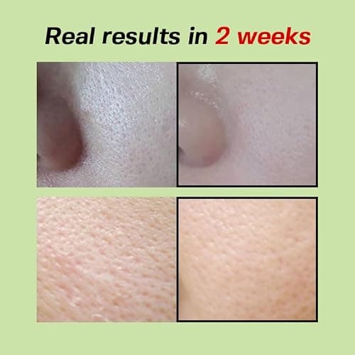 SUNGBOON EDITOR Green Tomato Pore Lifting Ampoule | Pore Minimizer Serum with Niacinamide & Green Tomato Extract | Hydrating & Firming Care for Sensitive Skin | Korean Skincare thumbnail 6