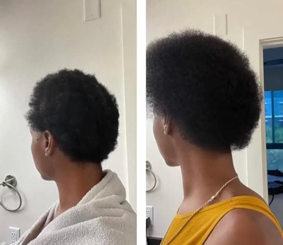 BUR BUR Growing Season Hair Growth And Repair Oil | With Burdock, Nettle Oil and Vitamin C for Visibly Fuller, Stronger and Shinier Hair. thumbnail 6