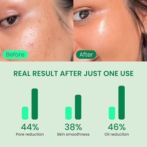 QUIA Dual-Action Toner Pads – Gentle PHA Exfoliation for Sensitive Skin – Instantly Hydrate and Minimize Pores – 70 Soft-Touch Korean Textured Pads – Blackhead and Blemish Control thumbnail 4