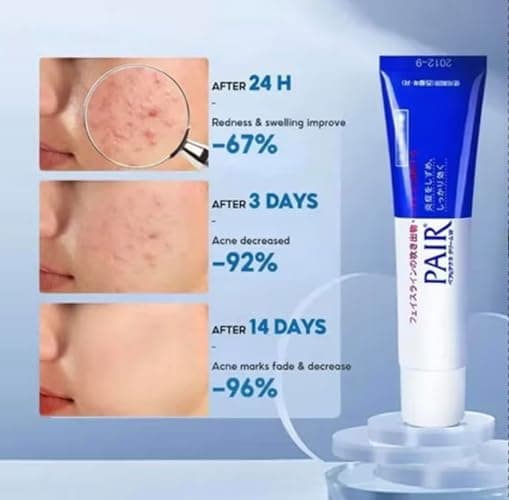 PAIR Acne Treat-ment Cream , Japanese Medicated Skincare 14g thumbnail 4