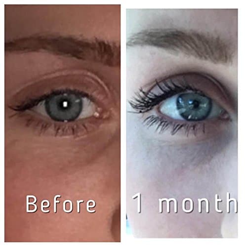 Pronexa Hairgenics Lavish Lash – Eyelash Growth Enhancer & Brow Serum with Biotin & Natural Growth Peptides for Long, Thick Lashes and Eyebrows! Dermatologist Certified, Cruelty Free & Hypoallergenic. thumbnail 9