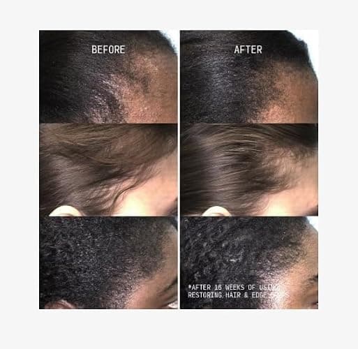 Cecred Restoring Hair & Edge Drops - Daily Peptide Serum For All Hair Types - (1.7 fl oz) thumbnail 3