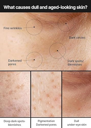 celimax Pore+Dark Spot Brightening Cream | with Niacinamide, Tranexamic Acid, TXA Cream, Pore Minimizer, Non-Irritating, Hydrating, For Sensitive Skin, 35ml thumbnail 4