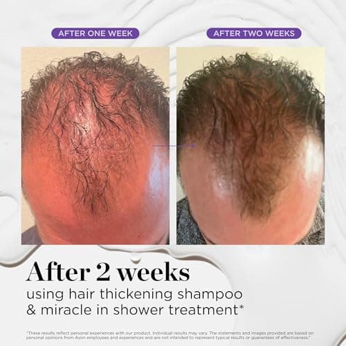 Dr. Groot Hair Thickening Shampoo, Korean Hair Care with Biotin, Rosemary Oil to Help Volumize Thinning, Damaged Hair, Hydrate Hair and Scalp, Biotin Shampoo, Scalp Revitalizing Solution thumbnail 6