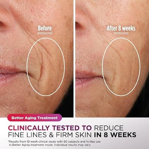 Shark CryoGlow LED Face Mask in Rose Glow, FW312PK | #1 Skincare Facial Device in the US, Combining High-Energy LEDs, Deep Infrared & Under-Eye Cooling thumbnail 5