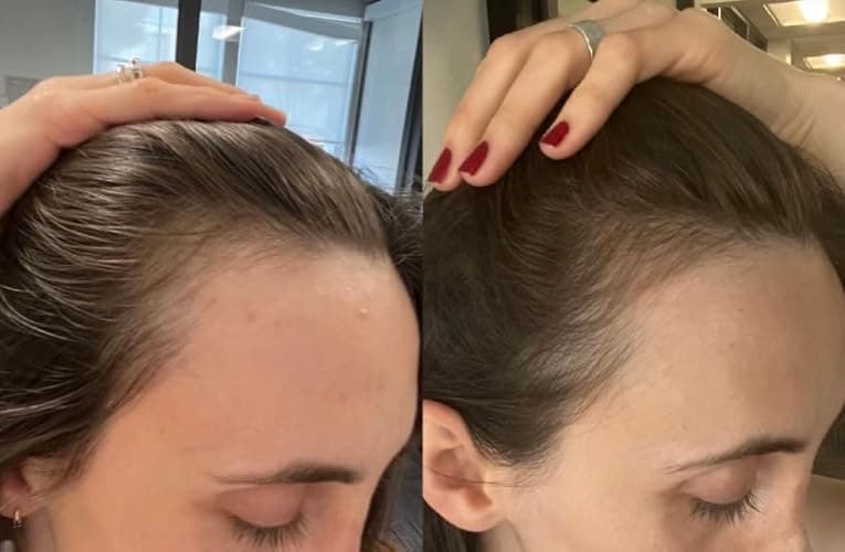 BUR BUR Growing Season Hair Growth And Repair Oil | With Burdock, Nettle Oil and Vitamin C for Visibly Fuller, Stronger and Shinier Hair. thumbnail 7