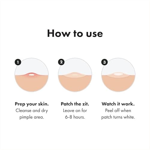 Mighty Patch™ Original patch from Hero Cosmetics – The #1 Hydrocolloid Acne Pimple Patch for Shrinking Zits and Whiteheads in 1 use; Nighttime Spot Stickers for Face and Skin (36 Count) thumbnail 7