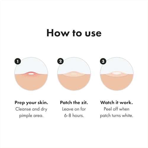 Mighty Patch™ Variety Pack from Hero Cosmetics - Hydrocolloid Acne Pimple Patches for Covering Zits and Blemishes, Spot Stickers for Face and Skin, Korean Skin Care, 26 ct thumbnail 6