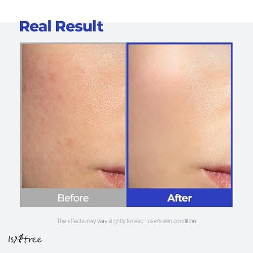 IsNtree Hyaluronic Acid Aqua Gel Cream 100ml, 3.38 fl oz | Korean Skincare | Lightweight Moisturizer | Quick-Absorbing Hydration | For Oily to Combination Skin thumbnail 4