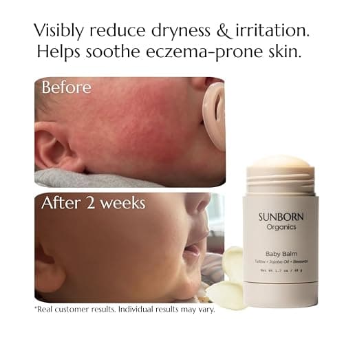 Organic Baby Balm thumbnail 2