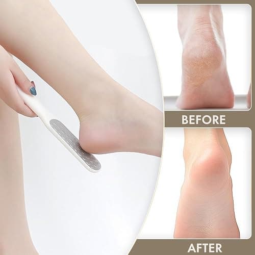 Beinilai Collapsible Foot Spa Bath with Heat,Bubble,Massage Rollers, Tea Tree Oil Foot Soak with Epsom Salt, Pedicure Foot File, Red Light,Removable Pumice Stone,Pedicure Foot Spa thumbnail 4