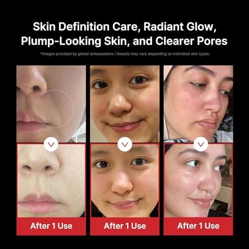 medicube All-in-One Black Duo für Collagen Glass Skin: Age-R Booster Pro Black (All-in-One Gerät) & Collagen Jelly Cream | Innovative Gesichtspflege für Absorption & Straffung | Korean Skincare thumbnail 5