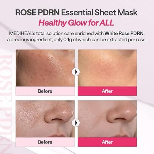 Mediheal Rose PDRN Essential Sheet Mask 4 pcs. 99% Pure White Rose PDRN & Hyaluronic Acid for hydrating, firming, and enhancing moisture barrier, skin firmness, and glow. Vegan formula. - 4 pcs - Rose PDRN thumbnail 6