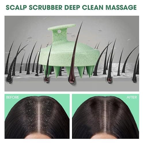 Hotosu Scalp Massager Brush for Hair Growth – Silicone Scalp Scrubber & Scalp Exfoliator – Manual Scalp Massager Brush for Wet or Dry Use – Hair Massager Scalp Shampoo Brush Tool (Green) thumbnail 9
