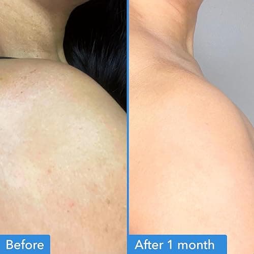 Good Molecules Discoloration Correcting Body Treatment - Anti-Pigment Cream with Niacinamide, Tranexamic Acid - Target Dark Spots and Moisturize - Skincare for Body thumbnail 3