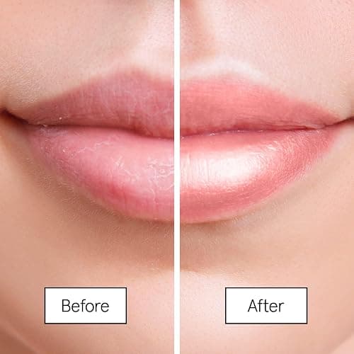 grace & stella Award Winning Lip Butter - Hydrating Lip Balm - Nourishing Lip Mask (1-pack) Travel Essentials, Travel Size Toiletries, Birthday Gifts for Women & Teens - Overnight Lip Repair - Vegan thumbnail 3