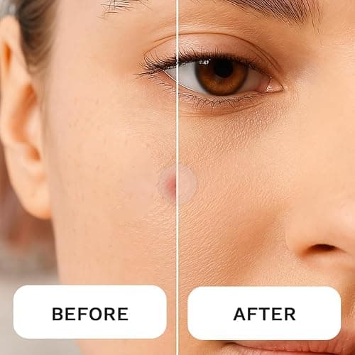 LE GUSHE K-BEAUTY Pimple Patches for Face (132 dots) - Hydrocolloid Acne Patch for Zits and Blemishes - Invisible Blemish Patches | Spot Cover Stickers for Glowing Skin | Korean Skin Care thumbnail 4