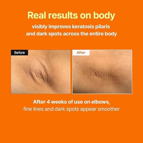 MEDITHERAPY Retinal Skin Booster Serum – Beginner Friendly Non-Irritating Retinaldehyde for Face and Body – Anti-Aging Retinol Pore Minimizer for Blemish Prone Skin– Korean Skin Care, 5.07 Fl.Oz Large thumbnail 4
