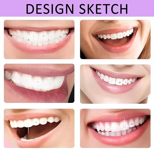 GXGM 1 ensemble Kit Strass Dentaire,Kit Dentaire Professionnel,Bijoux Gemmes pour Décoration de Dents De Ongles,Colle Dent, Avec Oeil-De-Cheval Blanc Diamants thumbnail 5