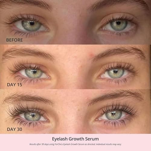 ForChics Eyelash Growth Serum - Prostaglandin-Free Lash Enhancing Serum for Longer, Thicker Lashes and Brows- Natural Formula, Visible Results in 2 Weeks - Vegan, Hormone-Free 0.10 fl. oz / 3ml thumbnail 2