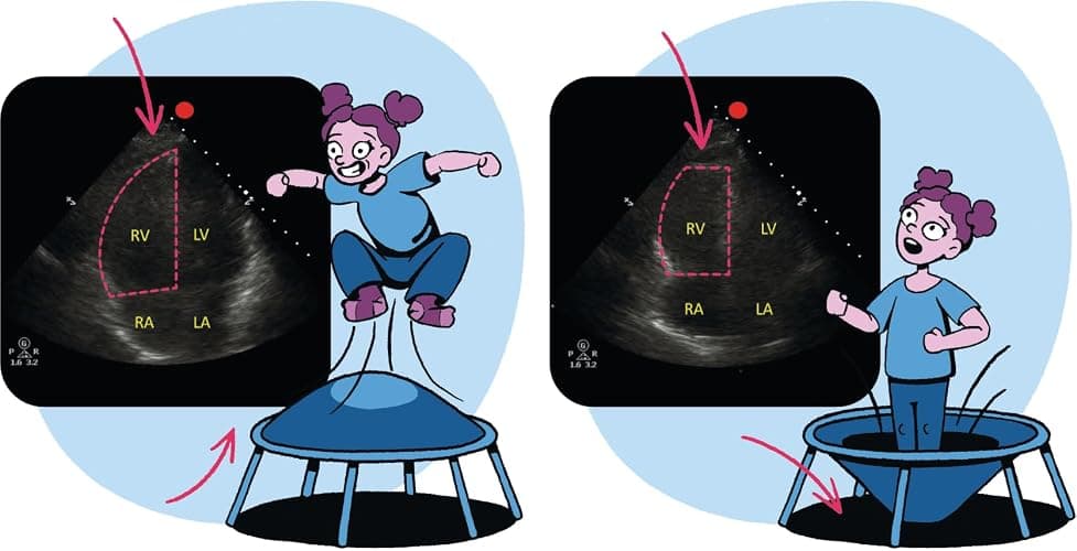 Critical Care and Hospitalist Medicine Made Ridiculously Simple thumbnail 9