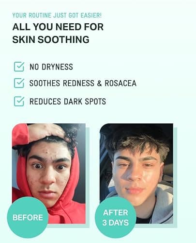 BRING GREEN ZINC TECA Serum with Niacinamide | Soothing Face Serum for Sensitive Skin, Pore Minimizing & Hydrating | Korean Skincare for Breakouts & Uneven Texture thumbnail 5