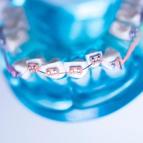 TrelaCo 1 Pack Fake Braces Artificial Tooth Decoration with Metal Wires Metal Bracket and Orthodontic Ligature Ties Practice Props for Dental Students Orthodontist Explain Props(Pink,Without Hook) thumbnail 2