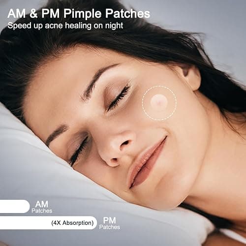 360 Stück Pickel Patch Hydrokolloid Acne Pimple Patches Anti-Akne Patch Unsichtbare für Tag & Nacht mit Teebaumöl, Salicylsäure,Centella Asiatica｜4 Größen 8 mm,10 mm,12 mm,14 mm thumbnail 2
