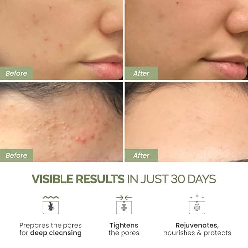 PLANTIFIQUE Clay Mask with Avocado & Superfoods - Korean Face Masks Skincare Products - Dermatologically Tested - Masque Visage Beauté - Gift Idea, 110g / 3.88 fl oz thumbnail 2