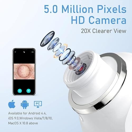 Facial Pore Blackhead Remover Vacuum, 1080P Camera Blackhead Remover, 20x Zoom, 8 LEDs ＆ 3 Suction Modes, 800mAh Battery & USB - 6 Heads Pore Cleaner Kit for Women&Men(Blue) thumbnail 2