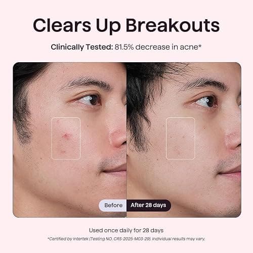 wavytalk Red Light Therapy Mask for Face, Glow Time LED Face Mask Light Therapy for Anti-Fine Line, Acne Treatment, and Skin Rejuvenation with Red, Near-Infrared Light, Blue and Amber Light Therapy thumbnail 5