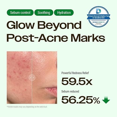YUMU Cica Exosome Zinc Blemish Relief Cream, Face Moisturizer for Sensitive, Acne-Prone Skin, Lightweight, Breakouts, Barrier Repair, Hydration, Soothing, Oil-Free, Korean Skincare (80 ml/2.70 fl.oz.) thumbnail 2